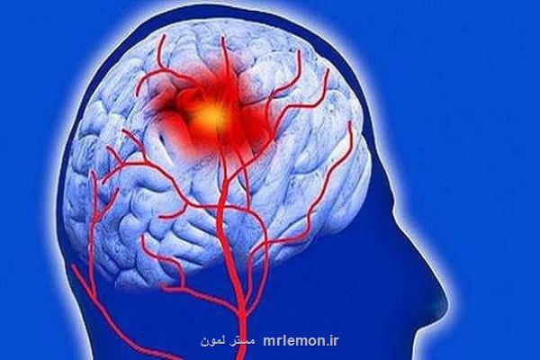 سکته مغزی سالانه 7 میلیون نفر را در جهان می کشد